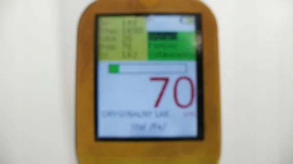 Toyota RAV4 III 05-08 moottorikansi OEM 360207033 image 8