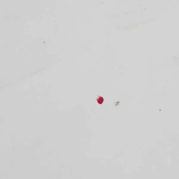 Motorhuv Citroen Berlingo Peugeot Partner II image 6